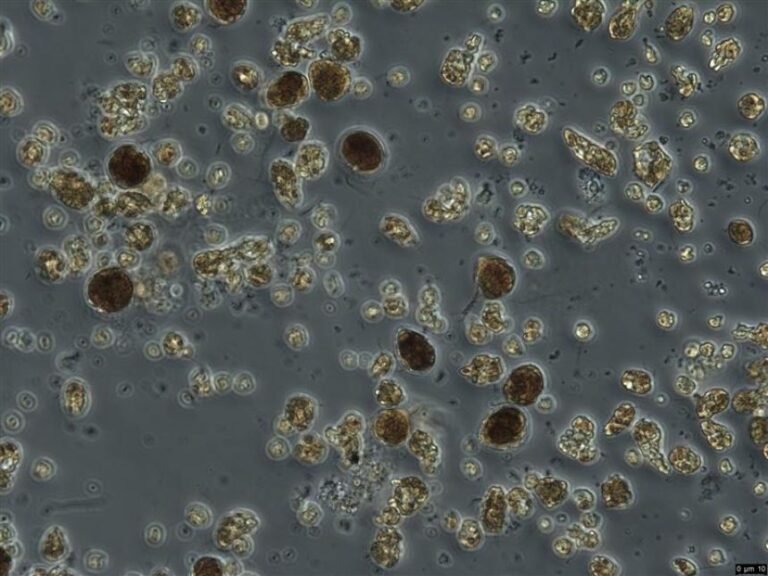 Project_Bl4_20260323_3_NIVA